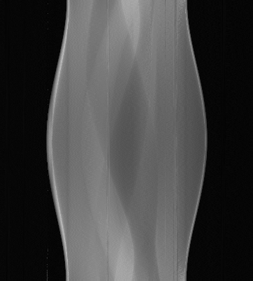 ../../_images/remove_all_stripe_sino.png